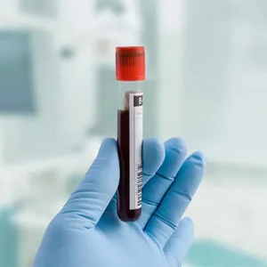 آزمایش در منزل