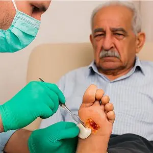 کارشناس زخم