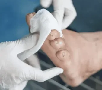 کارشناس زخم